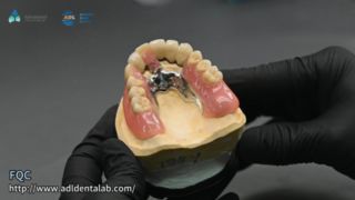 망원경 크라운 정밀 납땜 품질