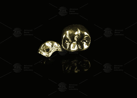 주문 귀금속 황금 60% 완전 금속 왕관 금 완성품 완전 금속 왕관 온라인 제조