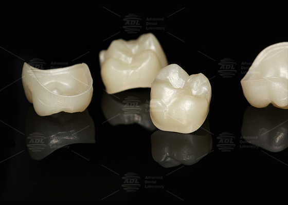 주문 천연 정면체 Zirconia 왕관 정밀 맞춤 정면체 치과 연구실 온라인 제조