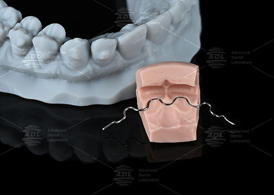 주문 중국 치과 연구실 보이지 않는 강한 U 모양 언어 와이어 유지 단일 스트랜드 편의 수준 정형 치아 치료 온라인 제조
