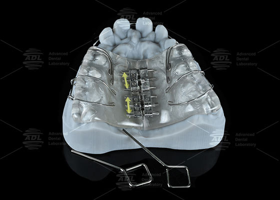 주문 중국 치과 연구실 화려한 스테인리스 스틸 나사 확장 온라인 제조