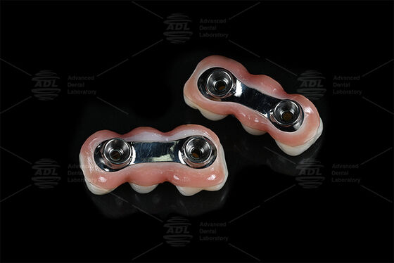 주문 강화 임플란트 바 CAD CAM 정밀 맞춤형으로 설계 대부분의 치아 임플란트 시스템과 호환 치아 복원 솔루션을 보장 중국 치아 연구소 온라인 제조