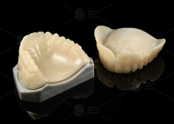 3D 프린트 치아실험생명 호환성 A1/A2/A3 완벽한 적합성 및 폐쇄성