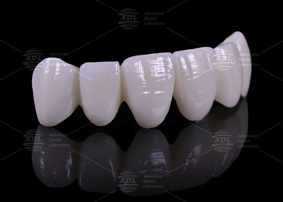 판매량 할인과 경쟁력 있는 가격으로 의료 산업에 맞춘 16가지 색조의 치아 인공 장비를 제공하는 치과 연구소